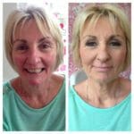 reduce redness at Pinkies salon Kent